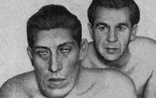 Акромегалия, огрубение черт лица и пр. — причины, симптомы, лечение