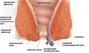 Мазь Ауробин — инструкция по применению при геморрое, аналоги