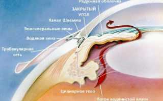 Причины и лечение закрытоугольной глаукомы