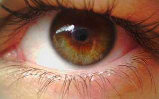 Признаки и лечение пигментной глаукомы