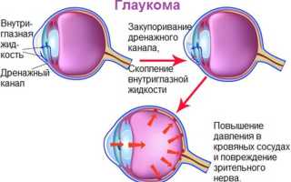 Давление и глаукома