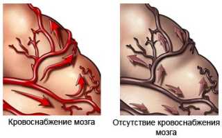 Деменция (приобретенное слабоумие)
