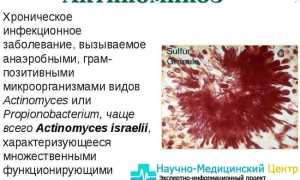 Кишечная палочка аэробная или анаэробная