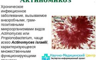 Кишечная палочка аэробная или анаэробная