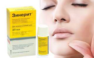 Зинерит — показания, инструкция по применению раствора от прыщей