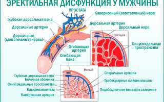 Эректильная дисфункция (импотенция, мужская сексуальная дисфункция)