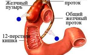 Симптомы воспаления желчного пузыря и способы лечения болезни