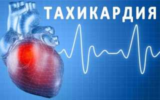 Причины и симптомы тахикардии, виды заболевания и способы лечения
