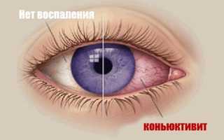 Инфекция и конъюнктивит