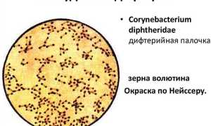 Как протекает дифтерия у взрослых — симптомы, лечение. Нужно ли делать прививку?