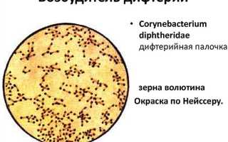 Как протекает дифтерия у взрослых — симптомы, лечение. Нужно ли делать прививку?