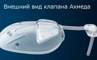 Аппарат Ахмеда