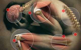 Хроническая боль