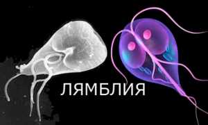 Лямблии у детей – что нужно знать родителям? Симптомы лямблиоза у детей и методы его лечения