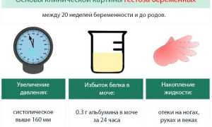 Преэклампсия и эклампсия