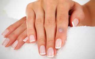 Бородавки на руках — как избавиться от проблемы? Эффективные методы лечения