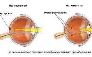 Проверка на астигматизм