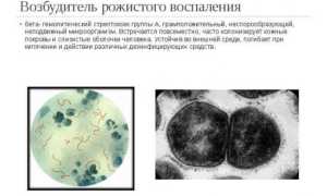 Рожистое воспаление ноги — причины, симптомы и лечение рожи на ноге