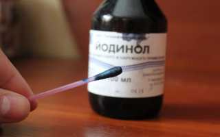 Как использовать Йодинол для полоскания горла, лечения грибка и ран?