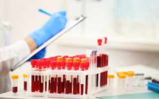 Показатели роэ при туберкулезе