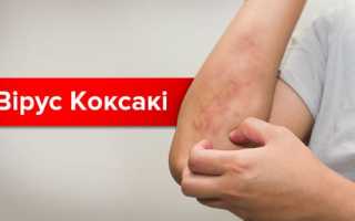 Вирус Коксаки — как передается, симптомы, инкубационный период, лечение
