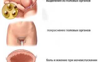 Как туберкулез влияет на бесплодие у мужчин