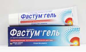 В каких случаях назначается Фастум гель? Правила использования препарата