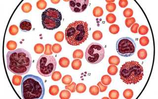 Базофилы повышены у взрослого — причины и лечение