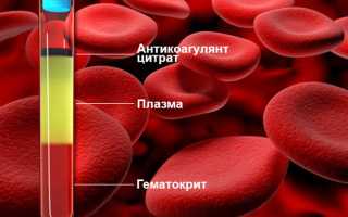 В крови повышен гематокрит — что это значит? Причины, возможные патологии