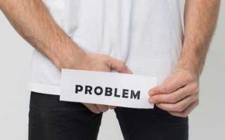 Когда у мужчин наступает импотенция?