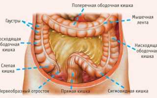 Как вовремя распознать рак кишечника? Симптомы, лечение, прогноз