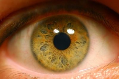 Глаз с пигментацией