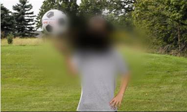 Пятно на глазу