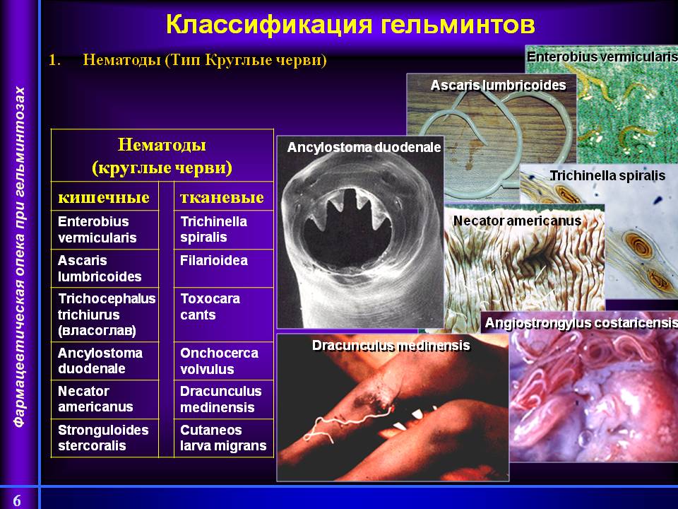 На фото слайде показана классификация гельминтов. Нематоды (Тип Круглые черви). Нематоды (круглые черви). Нематоды (круглые черви). Нематоды (круглые черви). Кишечные. Тканевые. Enterobius vermicularis. Trichinella spiralis. Ascaris lumbricoides. Filarioidea. Тrichocephalus trichiurus (власоглав). Toxocara cants. Ancylostoma duodenale. Onchocerca volvulus. Necator americanus. Dracunculus medinensis. Stronguloides stercoralis. Сutaneos larva migrans.