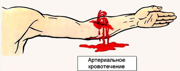 Артериальное кровотечение при правильных действиях можно остановить за 10 минут