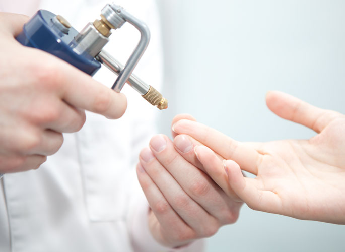 Способов для удаления бородавок в дерматологии просто уйма, поэтому подобрать именно тот вариант, который будет приятен по цене не составит особого труда