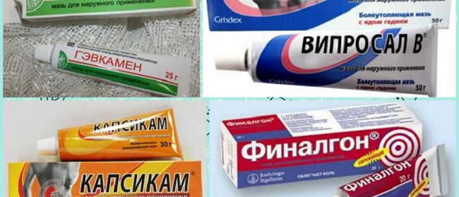 Гели и мази местного применения помогут снять болевой синдром при Люмбаго