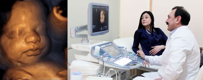 Допплер-УЗИ показывает множество важных показателей при беременности.