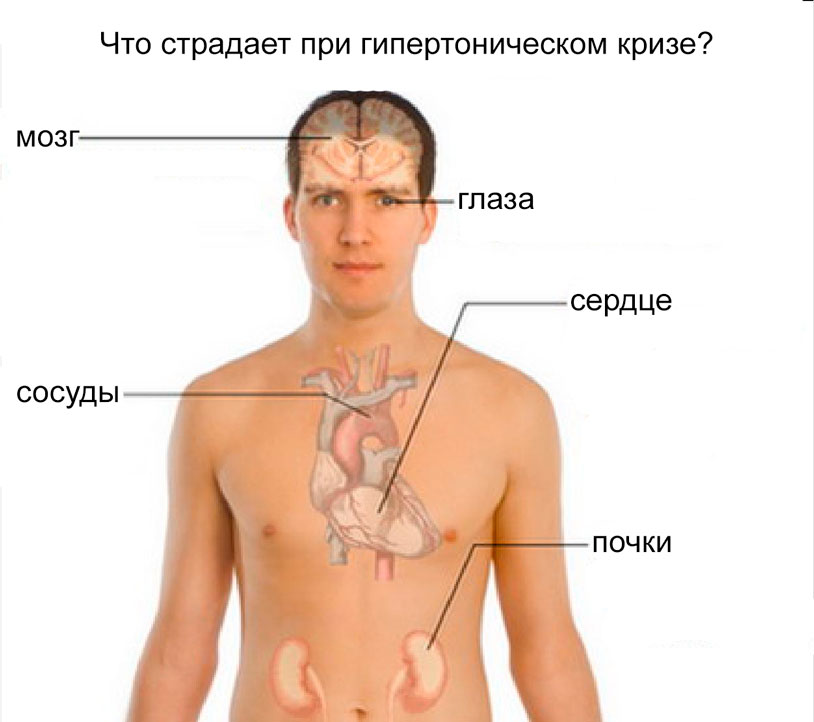 Гипертонический криз наносит вред практически всем органам в организме, т.к. во время криза организм испытывает чрезмерные нагрузки.