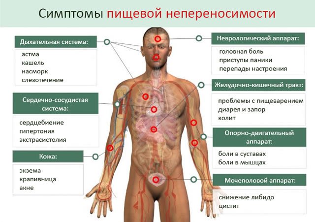 Диагностика целиакии чаще всего затруднена, а многие больные не догадываются о наличии аллергии на глютен