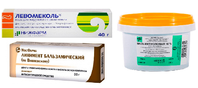Перед применением Ихтиоловой мази или ее аналогов стоит проконсультироваться с врачом, чтобы подобрать эффективное лечение