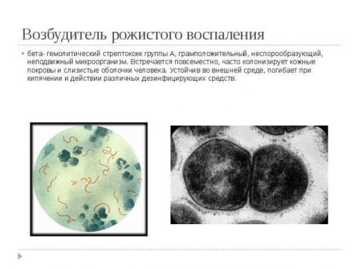 На фото показан возбудитель рожистого воспаления, вид под микроскопом - бета- гемолитический стрептококк группы А.