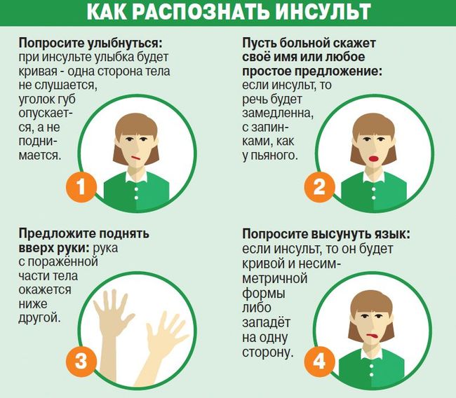 Распознать инсульт можно с помощью четырех простых правил