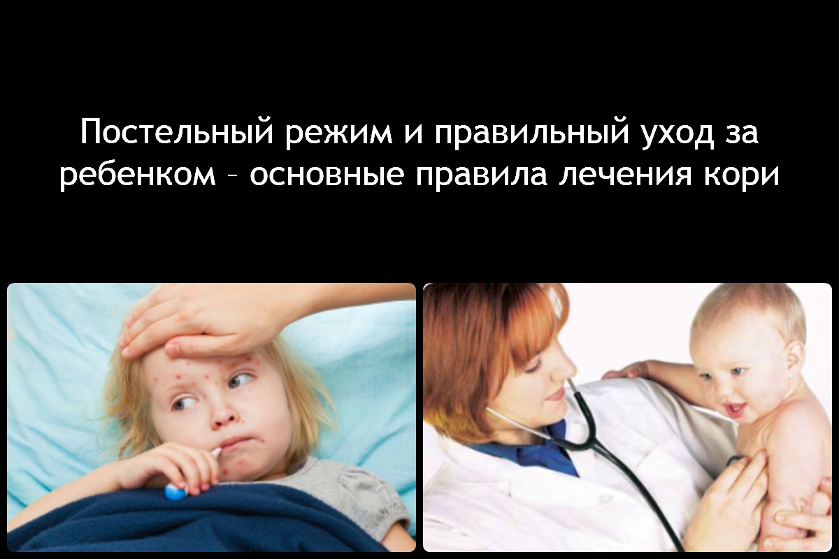 Обычно лечения кори у детей в большинстве случаев происходит дома и не требует госпитализации в больницу