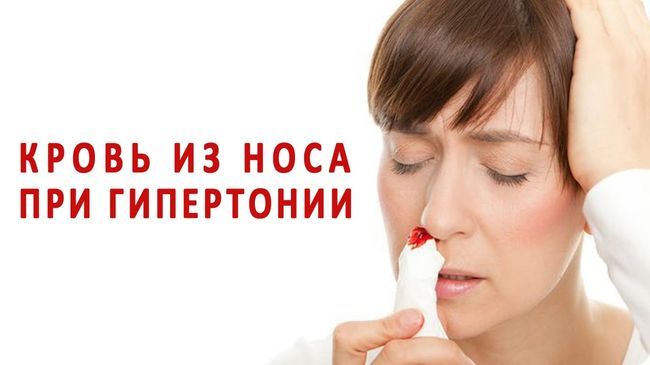Носовое кровотечение может быть у человека страдающего гипертонией