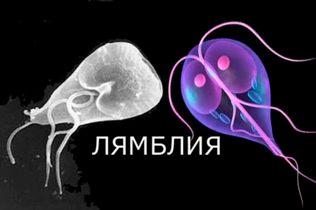 Очень часто лямблиоз у детей диагностируют в дошкольном и младшем школьном возрасте
