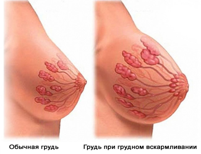 Мастит встречается у каждой третьей кормящей женщины