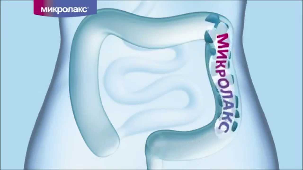 В отличие от обычной клизмы, микроклизмы от запоров МИКРОЛАКС не нуждаются в предварительной антисептической обработке и полностью готовы к применению