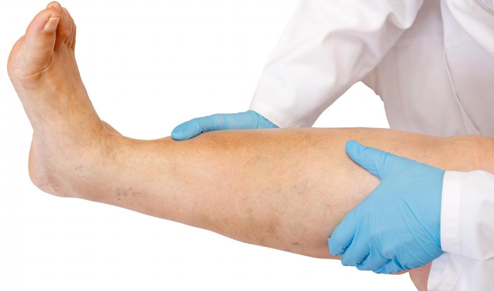 При любых постоянных отеках следует обращаться к врачу, т.к. любое самолечение 100% принесет больше вреда, чем пользы.