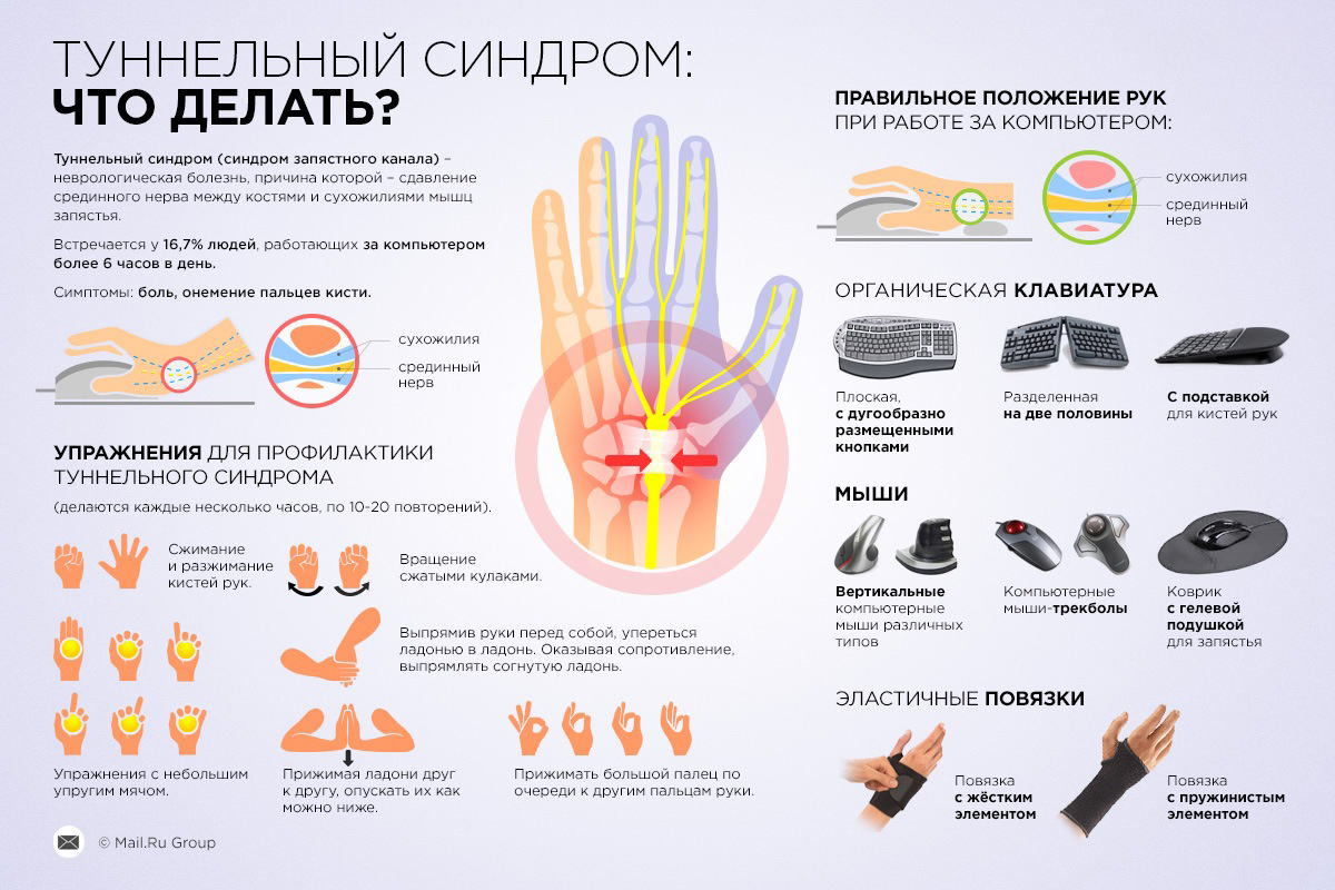 На фото: Что делать при туннельном синдроме в руке и запястье - упражнения для профилактики и рекомендации по правильному положению рук за компьютером, специальные клавиатуры, мышки и повязки.